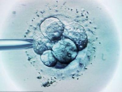 试管代怀需要多大年龄pds筛查囊胚送检的标准都有哪些？